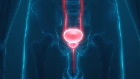 Getty Images prostate