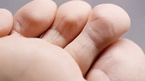 Getty Images Toes