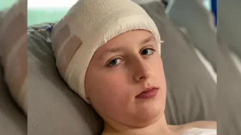 University Hospital Southampton Milo Euling with bandage around his head