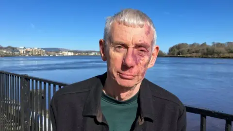 A man with grey hair, wearing a black jacket over a green top. He is standing in front of railings on the riverfront.