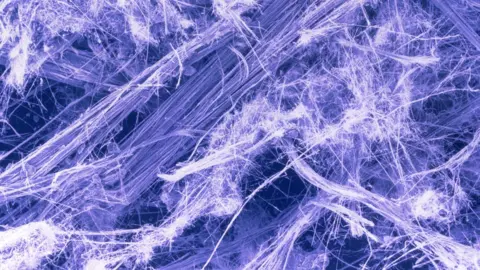 Science Photo Library Asbestos