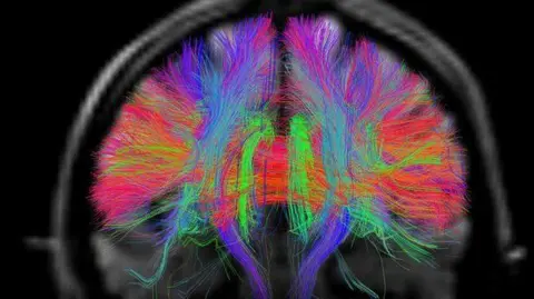 Fly brain sheds light on human thought process