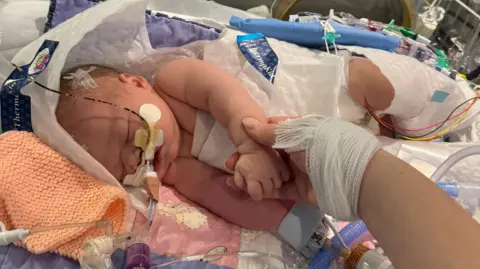 Russo family The hand of Bryony Russo holds Emmy's hand. The baby has tubes attached to her and is lying in a small intensive care bed covered with blankets.