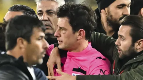 Referee Halil Umut Meler's face swells after Faruk Koca, President of MKE Ankaragucu throws a punch