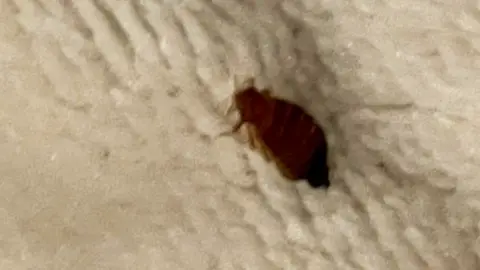A bedbug at Rebecca Horgan's Butlins accommodation