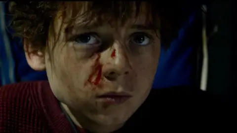 Alfie Williams is dressed as his character Spike from 28 Years Later: The Bone Temple. He looks directly into camera, and appears to be injured with blood on his face. 