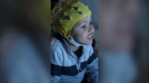 A young child is wearing a yellow, monitoring skull cap with wires.