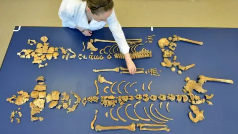 North News and Pictures Skeletons being reassembled