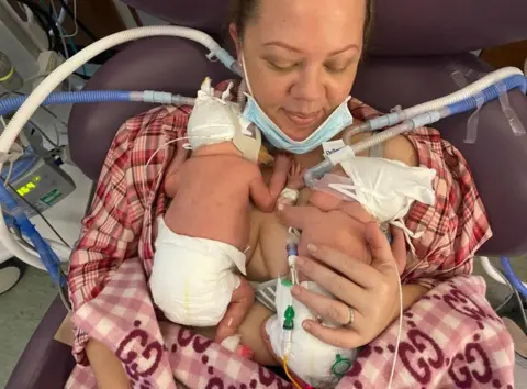 Jade Crane The twins at 10 weeks