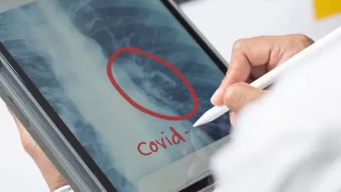 Getty Images lung x ray on screen with covid circled in red