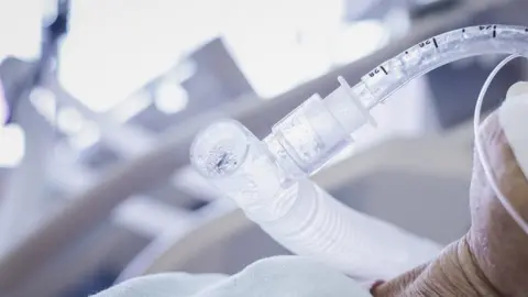 Getty Images Patient on ventilator