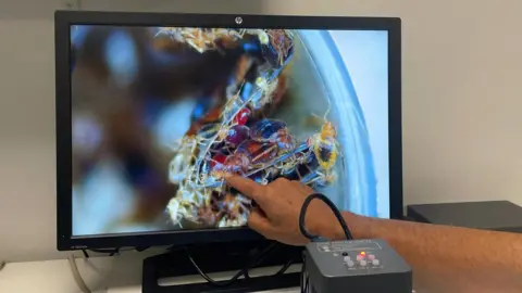 Beg bugs displayed on a screen at Marseille hospital