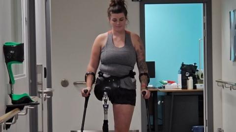 A young woman who has had her right leg amputated stands on two crutches 