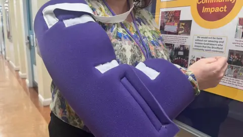 A woman wearing the 'Bradford sling' on her arm