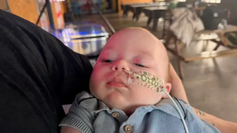 BBC News/Jasmine Lowe A baby in his dad's arms, he has large blue eyes. His head is resting in his mother's arms and he's wearing a blue top with blue buttons. Due to his condition his body is floppy and he can't keep his head up naturally. 