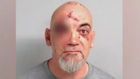 Police custody image of Kevin Horswill, shown in a grey sweater and with several injuries to his face. He is bald and has a grey goatee. His right eye is blurred out due to the extent of his injury.