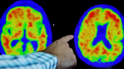 Reuters Two brain scans are pictured in blue, green, red and yellow on a black background. A man's finger is pointing at the scans.