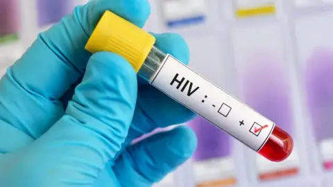 A test tube is held by someone wearing blue surgical gloves. The vial contains blood with a sticker on that says HIV with a tick in a box next to a + mark. 
