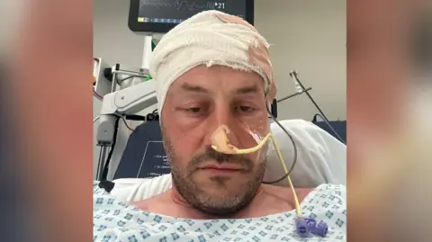 Collect/PA Real Life George Wade in a hospital bed with a bandage on his head and tube in his nose