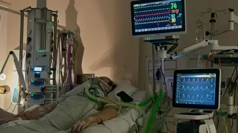 supplied A man lies in a hospital bed attached to several tubes. A series of machines next to the bed shows graphs and squiggly lines