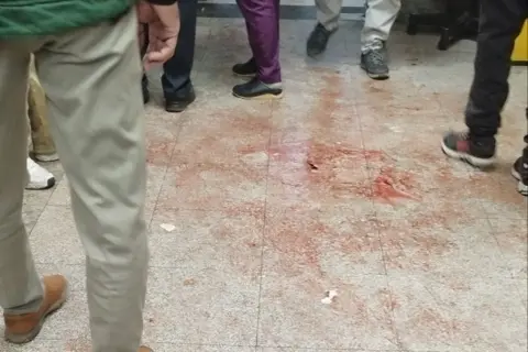 Blood on the floor of a hospital in Tehran, Iran