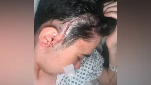 Supplied A photograph of a Sonny with a large scar running from his ear to the top of his forehead. He is wearing a hospital gown and has a tube inserted into his nose.
