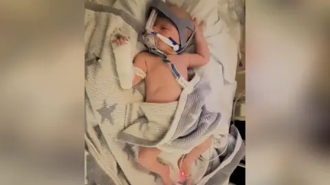 Cara Read Saxon as a baby lying in a hospital bed. He is receiving oxygen through a tube which is attached to his head via a brace. A blanket covers part of his body and he has a bandage on one arm