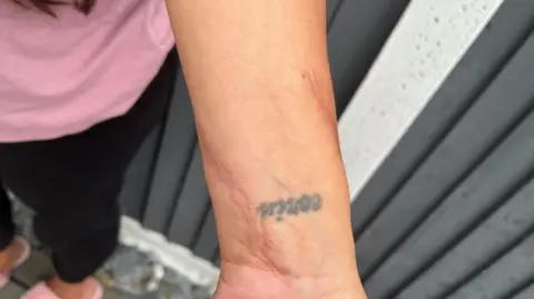 Tony Fisher/BBC Scars on the arm of a woman where a knife has pierced through her wrist. There is a small tattoo on her wrist.