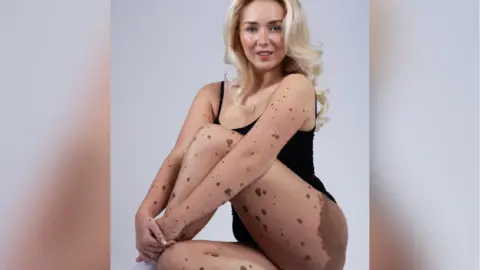 Scarlett Clarke Clarke wearing a leotard and sitting on the floor with her left leg crossed over her right and her hands over her left ankle. Her hair has been styled in a down do and she is part smiling at the camera. Her CMN is visible in varying sizes across her face and body and there is a bigger area on her top left thigh.