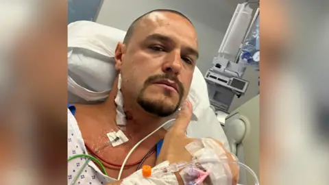 A man with shaved brown hair and a goatee beard give the thumbs up as he lies in a hospital bed. He is connected to  has numerous tubes and wires connected to him as well as a dressing on the side of his neck. He is giving a thumbs up to the camera.