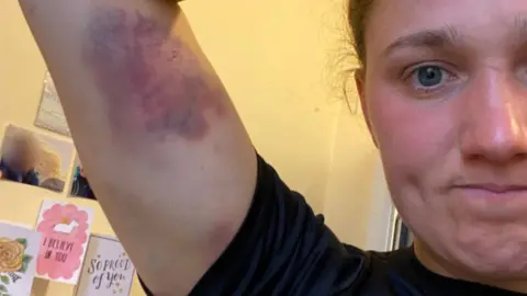 Lt Lily-Mae Fisher Lt Fisher shows a bruised right arm from her time in training in a selfie