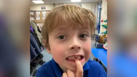 Sebe, in a blue polo shirt, shows a gap in his lower teeth at the front after he pulled it out during the dress rehearsal.