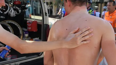 Getty Images Sun cream being applied