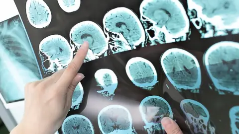 Getty Images brain scan pictures
