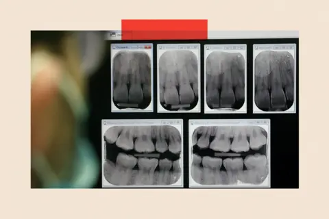 EPA-EFE/REX/Shutterstock An NHS dentist looks over a customer's x-rays at a National Health Service (NHS) dental clinic 