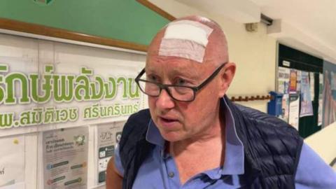 A man from shoulder up with no hair, glasses and a plaster on his head stood in front of a wall
