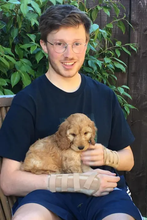 Fergal Mackie Fergal Mackie wearing two casts on both of his wrists, holding a dog. He is wearing glasses and a dark coloured t-shirt and shorts.