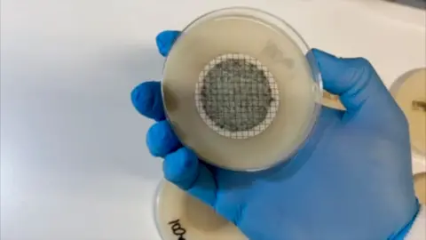 A sample showing ESBL bacteria