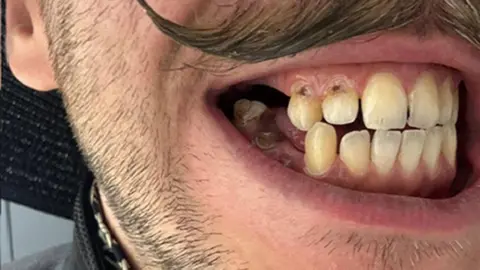 A close up photo of Lajos Csendes' teeth.