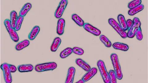Getty Images Clostridium difficile bacteria