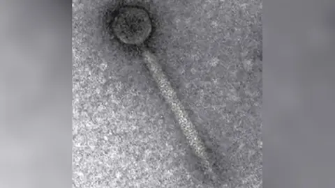 Mary Parker/Quadram Institute Colneyvirus