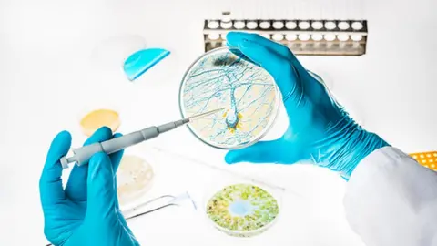 Science Photo Library Research into Alzheimer's in the lab with a petri dish