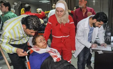 EPA/SANA A woman with facial injuries receives first aid at an emergency room in Al Mouwasat Hospital, Damascus