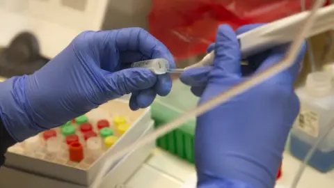 Getty Images UW immunology lab - hands holding lab equipment