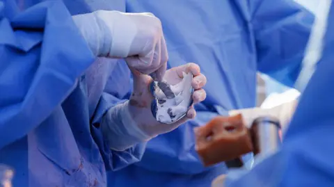 A gloved surgeon is working on a knee prosthesis during surgery. The medic is wearing blue scrubs and white gloves and holding an implement.