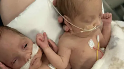 Provided The image is a close-up view of two newborn infants lying side by side on a padded surface, partially covered by a blanket.