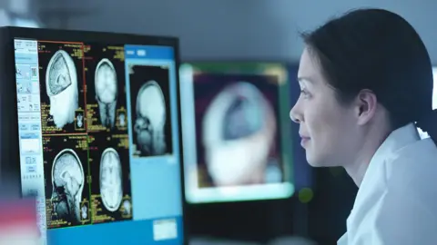 Getty Images Doctor looking at MRI scans on a screen