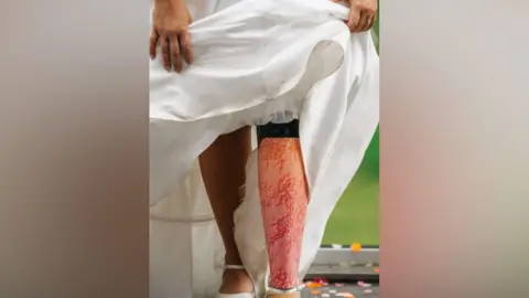 A bride holds up her wedding dress to show a prosthetic leg decorated with a pink and orange floral pattern. Only the bottom half of the bride can be seen. There is confetti on the ground behind her.
