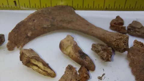 The picture shows a jawbone, two teeth and bone fragments 
