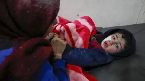 AFP A Syrian child injured in a reported Russian air strike at a hospital in Ariha, Idlib province (30 January 2020)